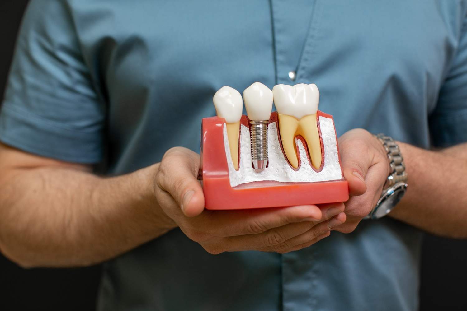Fases del tratamiento de implantes dentales paso a paso