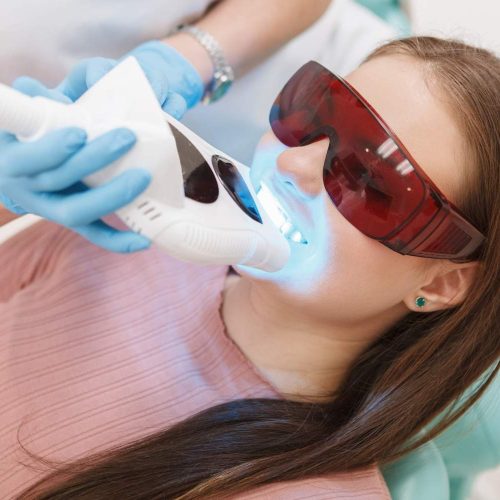 paciente-sexo-femenino-recibiendo-blanqueamiento-dental-dentista-profesional