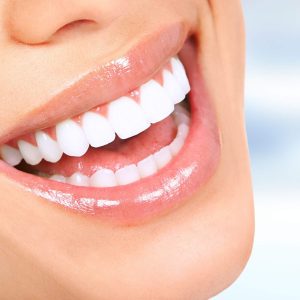 Estética Dental en El Cañaveral